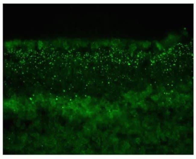 100 UG MONOCLONAL ANTIBODY, UNCONJUGATED