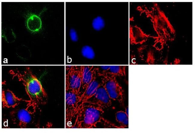 100µg ANTI-CEP170, MOUSE MONOCLONAL ANTI