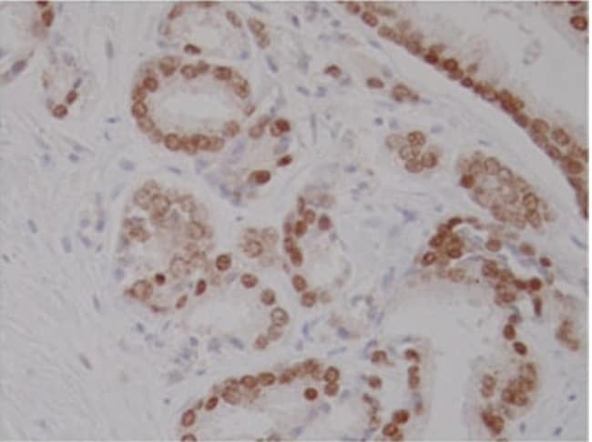 100 UG ANTI-ANDROGEN RECEPTOR, HUMAN CLO