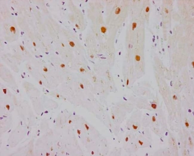 ANTI- ESTROGEN RELATED RECEPTOR ALPHA 10