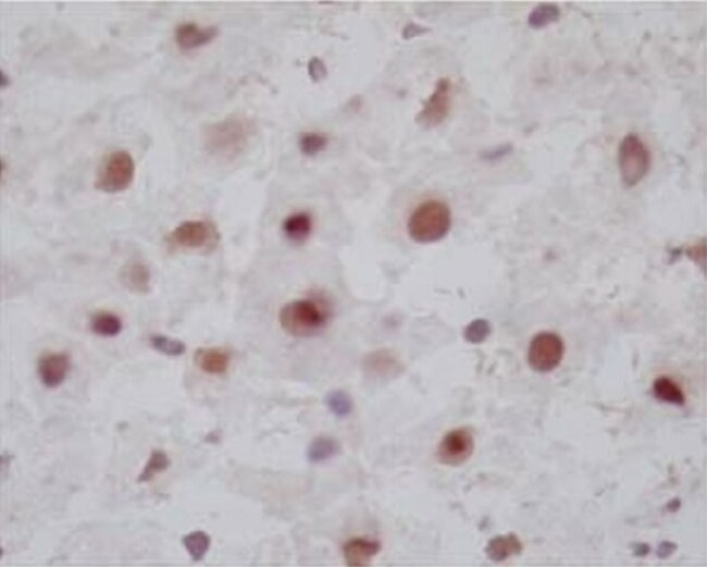 ANTI-FARNESOID X RECEPTOR, AFTER CLONE 1