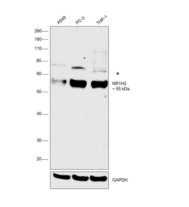 ANTI-LIVER X RECEPTOR BETA, Human CLONE: