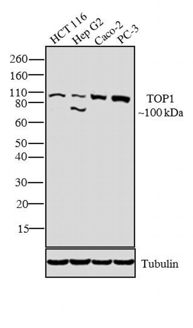 100 UG ANTI-TOP1, MOUSE MONOCLONAL ANTIB