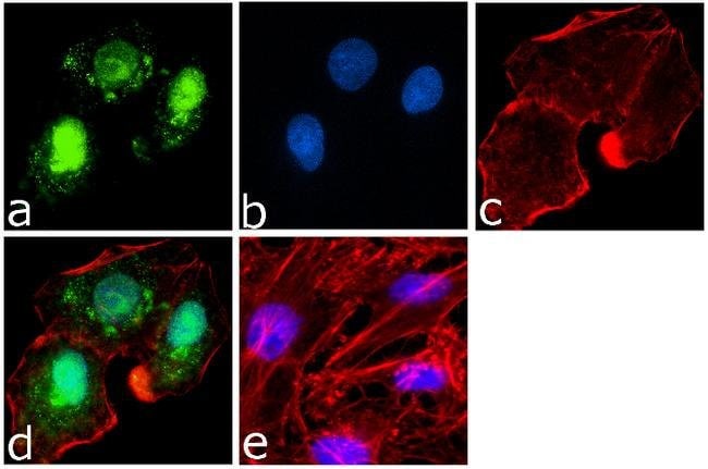 ANTI-PARP CLONE: 123, MOUSE MONOCLONAL 1