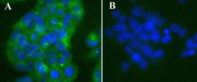 ANTI-NFKB (P65), MOUSE MONOCLONAL ANTIBO