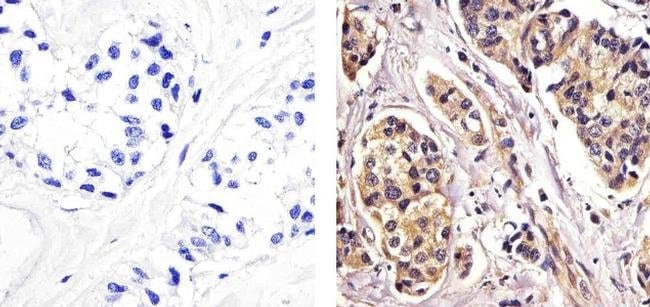 ANTI-RELB (VIRAL RETICULOENDOTHELIOSIS 1