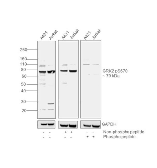 100UL GRK2 [PS670] PAB GLYC 100 UL