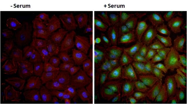 AKT [PS473] MAB, 10 BLOT BIOSOURCE (TM)