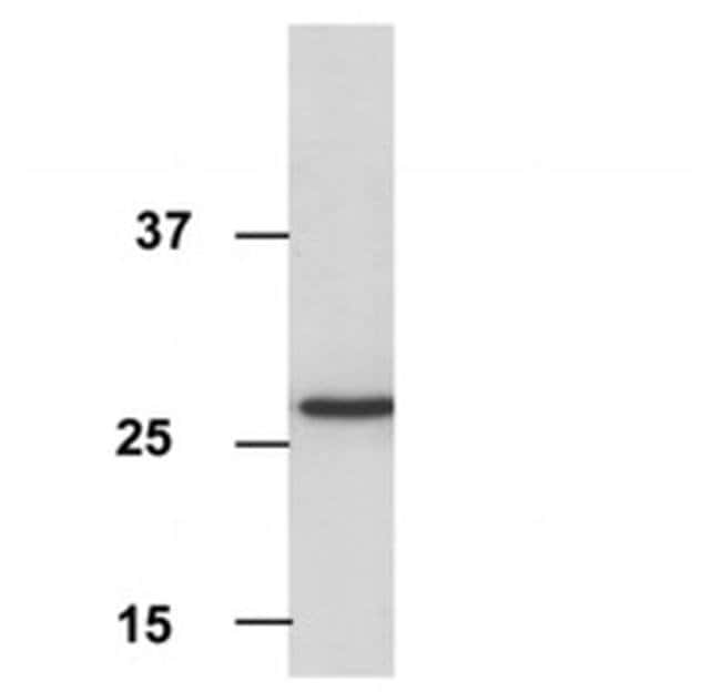 ANTI-PORIN YEAST MITOC MONO AB, 100 UG