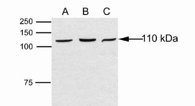 100µg ANTI-DAB2IP, RABBIT POLYCLONAL ANT