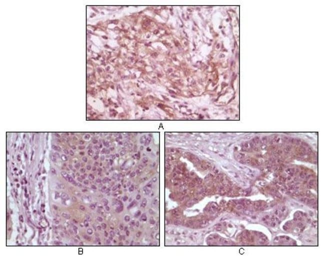 4E-BP1 Monoclonal Antibody 100 µl µL