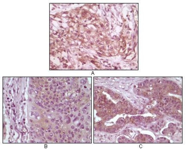 4E-BP1 Monoclonal Antibody 100 µg µG