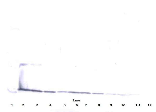 100UG ANTI-HUM IL-17A PEPROTECH