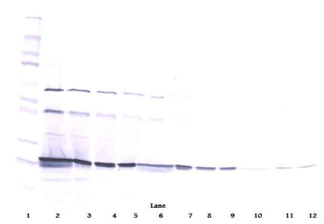 100UG ANTI-HUM CARDIOTROPHIN-1