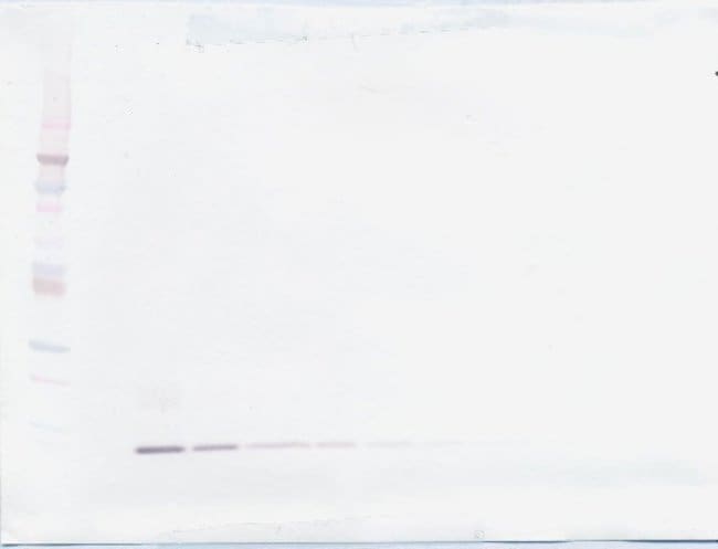 100UG ANTI-HUM MIP-5 PEPROTECH