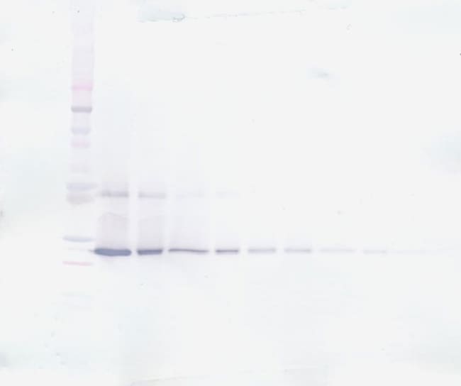100UG ANTI-HUMAN CNTF PEPROTECH
