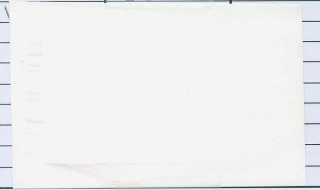 100UG ANTI-HUMAN BD-2 PEPROTECH