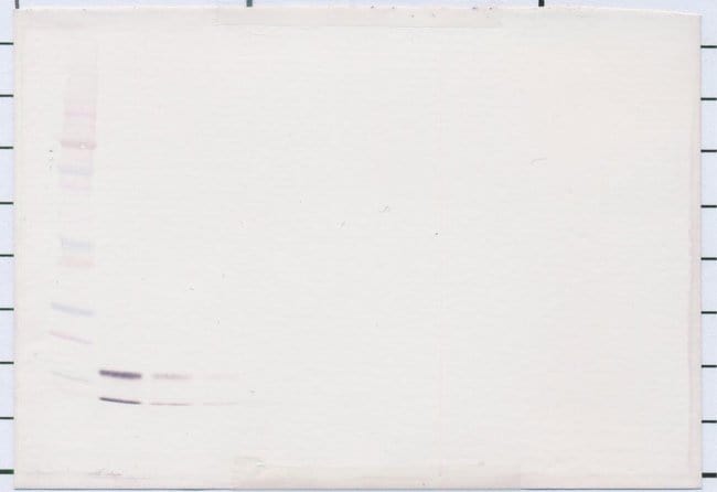 100UG ANTI-HUM RESISTIN (POLY. RB)