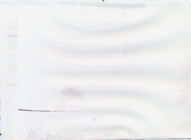 100UG ANTI-HUM RESISTIN (POLY. GT)
