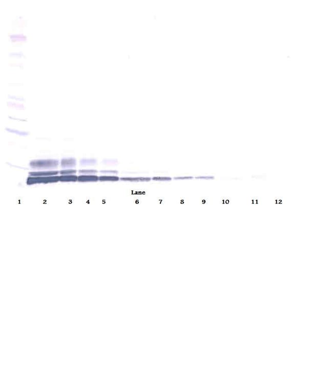 100UG ANTI-HUM LD78BETA PEPROTECH