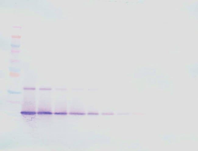 100UG ANTI-HUMAN IL-21 PEPROTECH