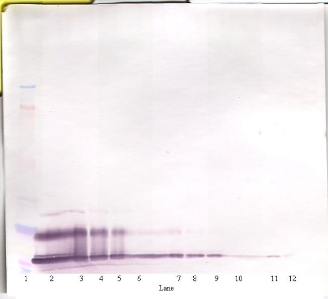 100UG ANTI-HUMAN CXCL16 PEPROTECH