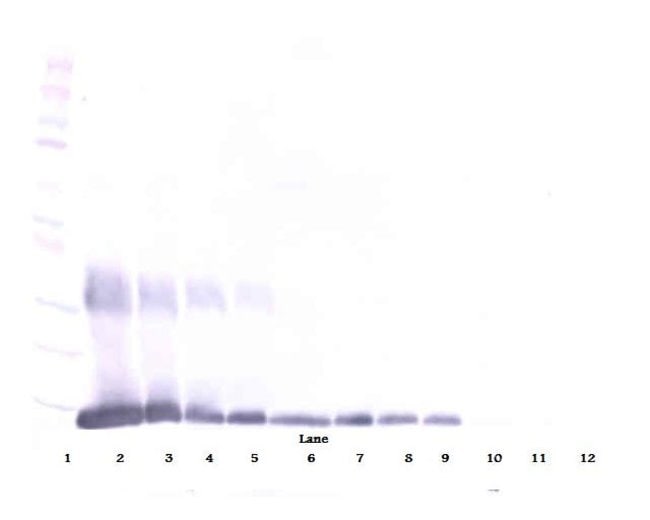 100UG ANTI-HUM GALECTIN-1 PEPROTECH