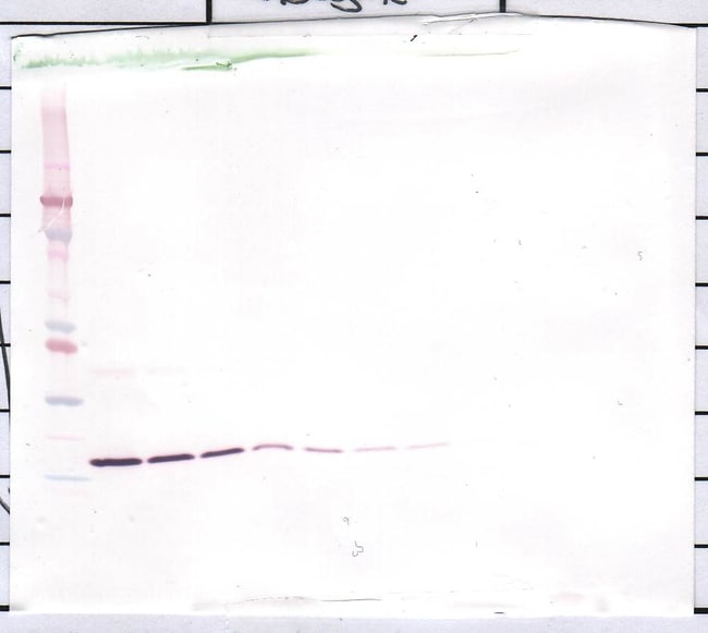 100UG ANTI-HUMAN IL-1BETA PEPROTECH