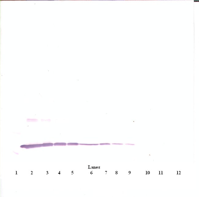 100UG ANTI-HUMAN IL-3 PEPROTECH