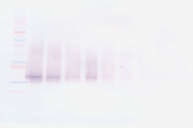 100UG ANTI-HUMAN IGF-BP3 PEPROTECH