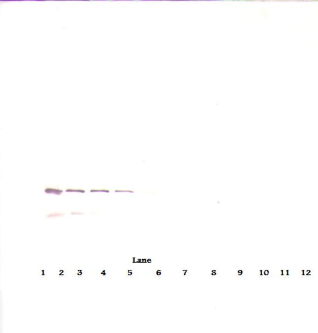 100UG ANTI-HUMAN IGF-BP7 PEPROTECH