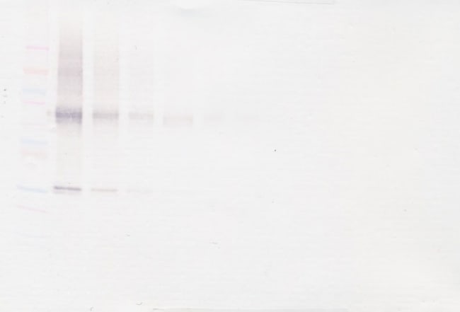 100UG ANTI-HUM ADIPONECTINPEPROTECH