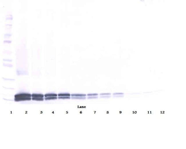 100UG ANTI-HUMAN IL-17B PEPROTECH