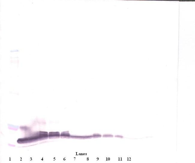 100UG ANTI-HUM BETACELLULIN