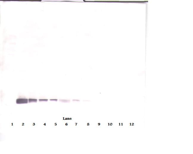 100UG ANTI-HUM ENDOSTATIN PEPROTECH