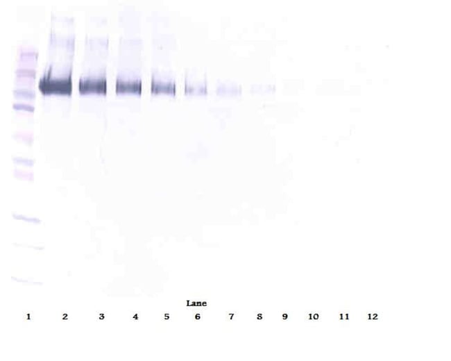 100UG ANTI-HUM EGF RECEPTOR (EGFR)