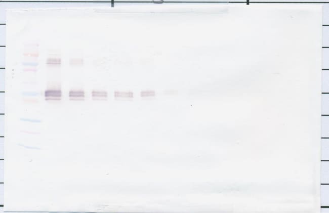 100UG ANTI-HUMAN SCD14 PEPROTECH