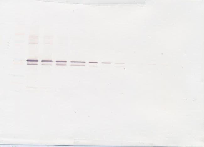 100UG ANTI-HUMAN MMP-3 PEPROTECH