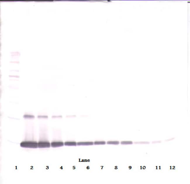100UG ANTI-HUMAN GM-CSF PEPROTECH