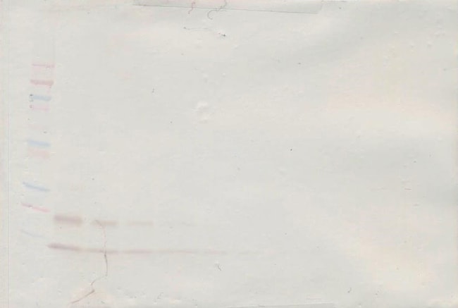 100UG ANTI-HUM MCP-1 PEPROTECH