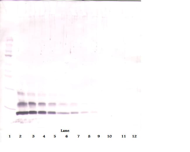 100UG ANTI-HUMAN MIP-1BETA (CCL4)