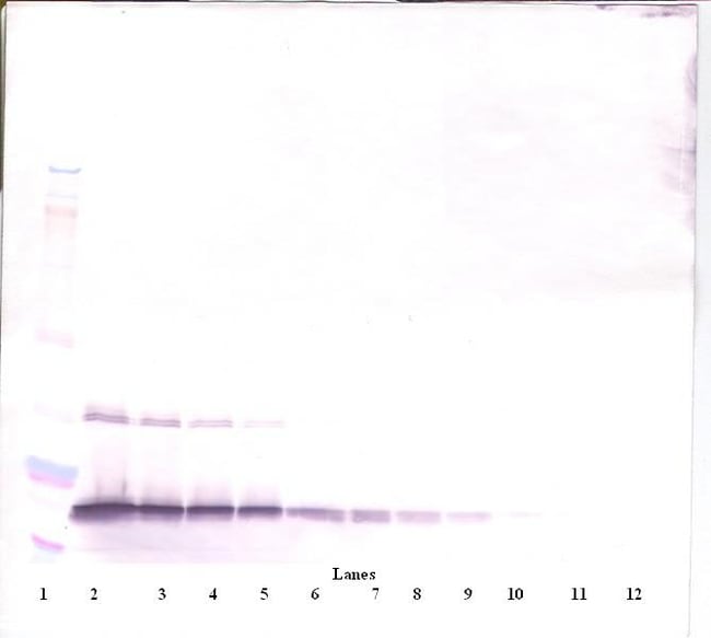 100UG ANTI-HUMAN G-CSF PEPROTECH