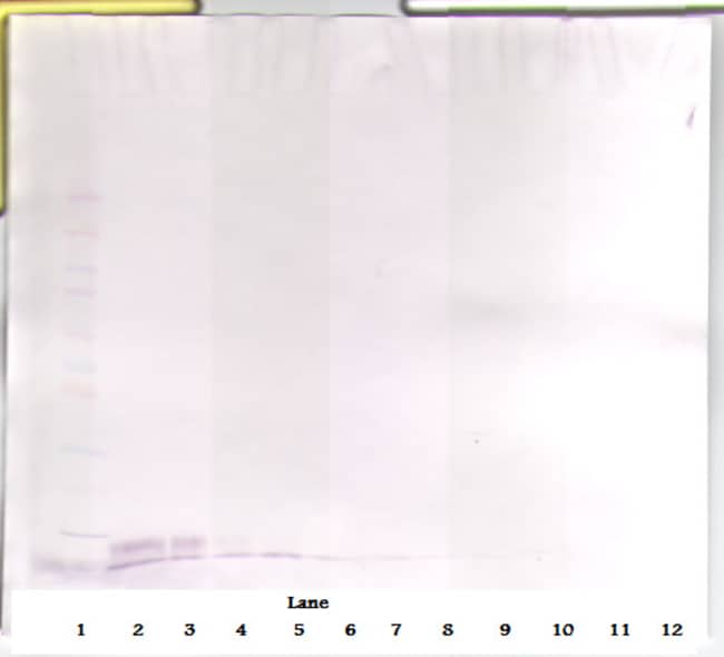 100UG ANTI-HUMAN EGF PEPROTECH