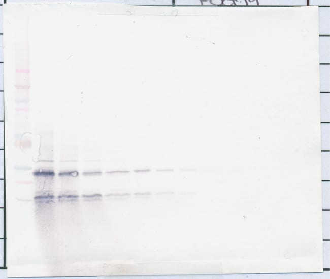 100UG ANTI-HUMAN PDGF-BB PEPROTECH