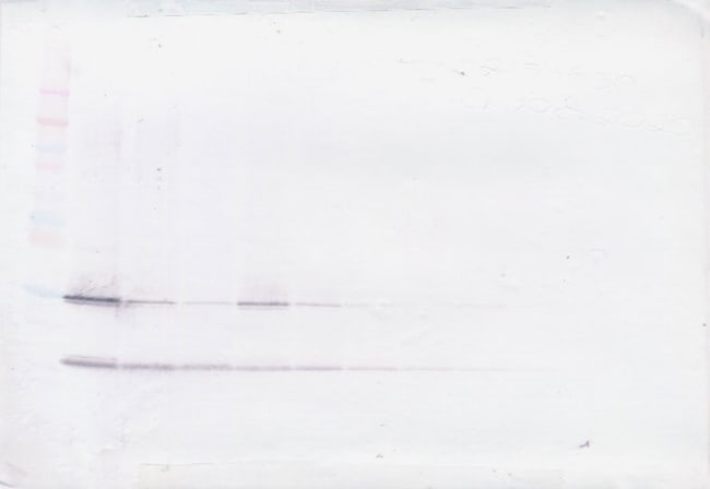 100UG ANTI-HUMAN GDNF PEPROTECH