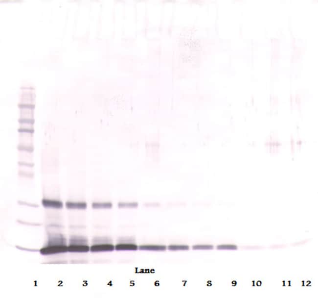 100UG ANTI-HUMAN LEPTIN PEPROTECH