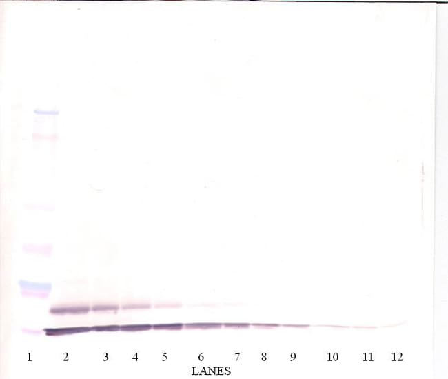 100UG ANTI-HUM TARC PEPROTECH