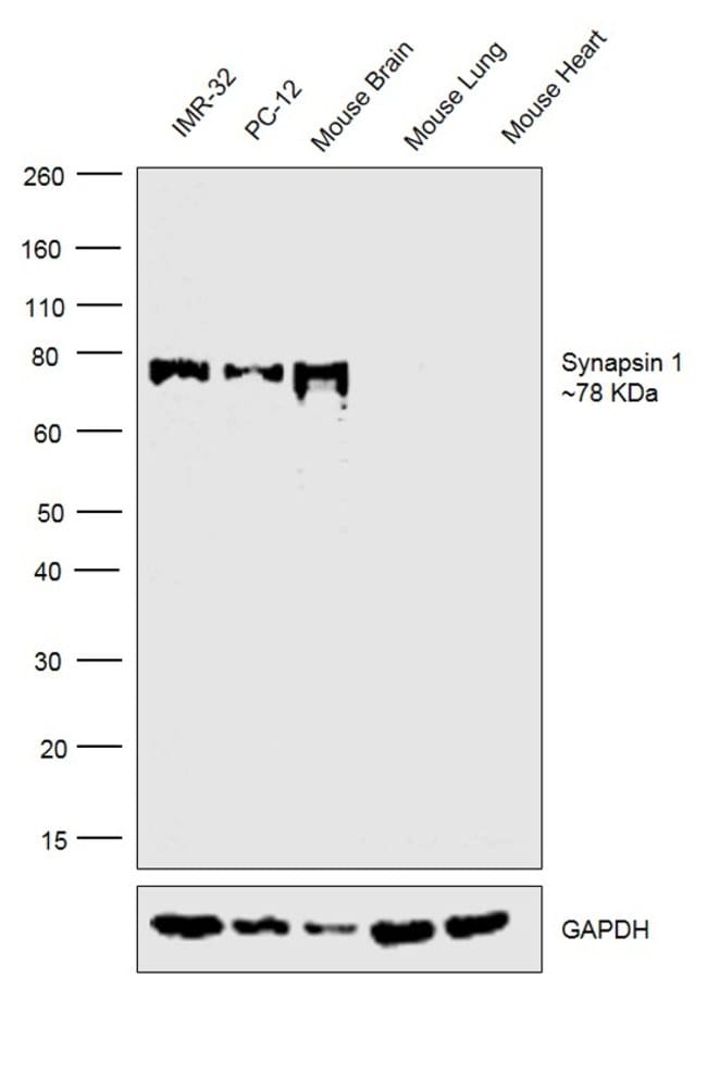 10UG RABBIT ANTI-SYNAPSIN I ZYMED .