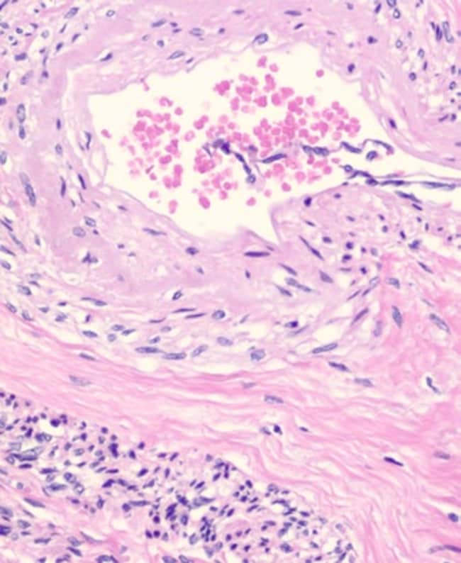 4 LT HARRIS NON-ACIDIFIED HAEMATOXYLIN C