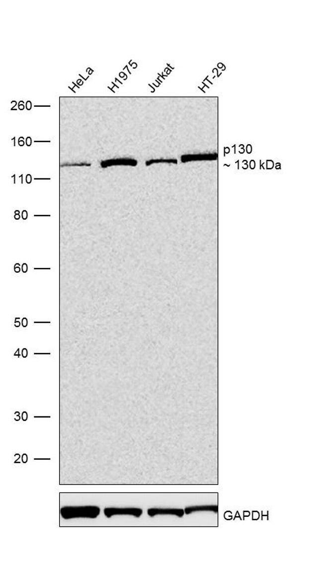 100UG RBL2/P1307H2L13MONOANTIBODY 100UG